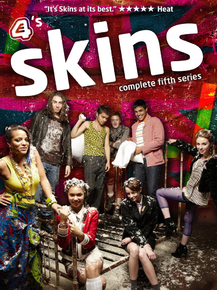 Skins | Молокососы